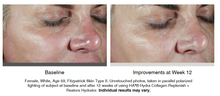 Load image into Gallery viewer, HA5 Hydra Collagen Replenish + Restore Hydrator