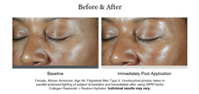 Load image into Gallery viewer, SkinMedica HA5 Hydra Collagen Replenish + Restore Hydrator
